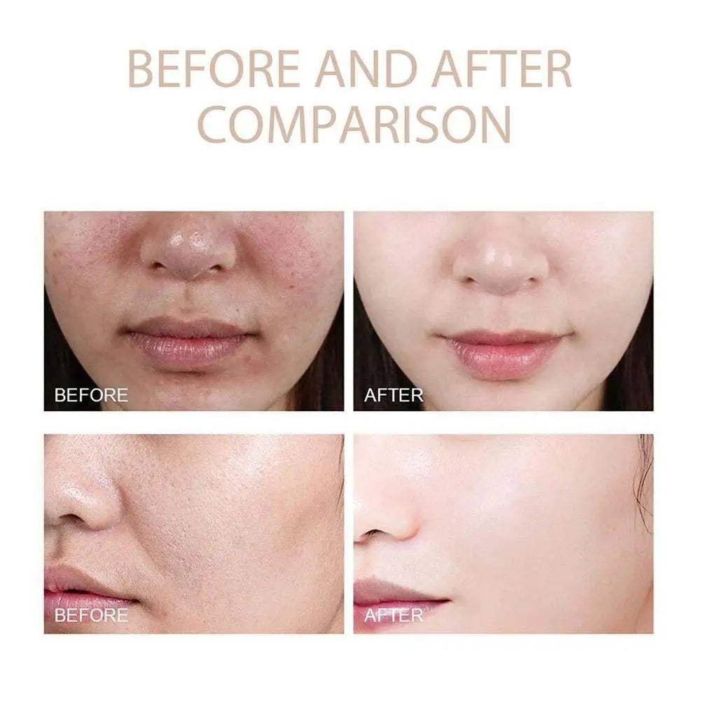 Revitalize Your Skin with Dr. Melaxin Rice Exfoliating Serum - Hydrating, Blackhead-Busting, and Pore-Shrinking Korean Face Care!