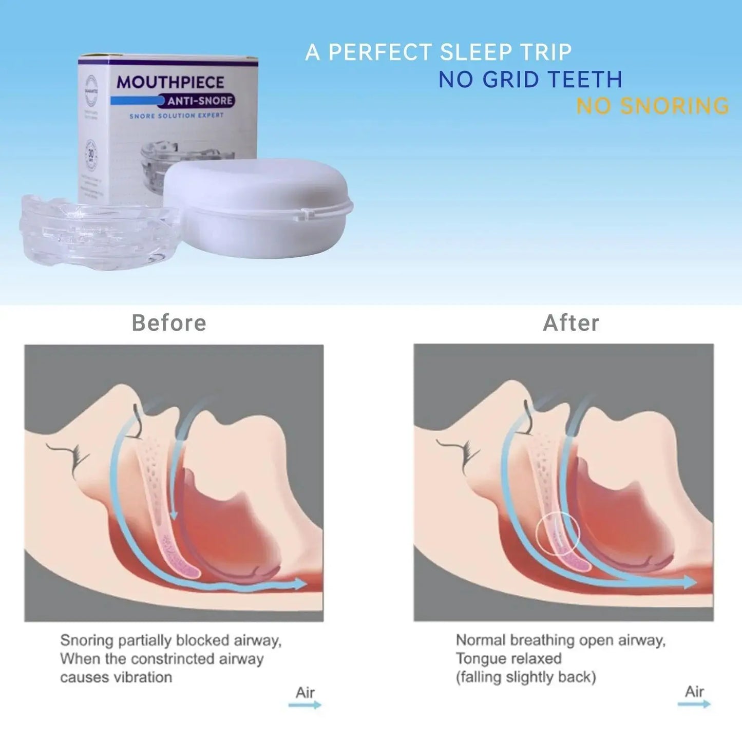 Transform Your Sleep with Our Adjustable Anti-Snoring Mouth Guard – Perfect for Bruxism Relief and Quality Rest!