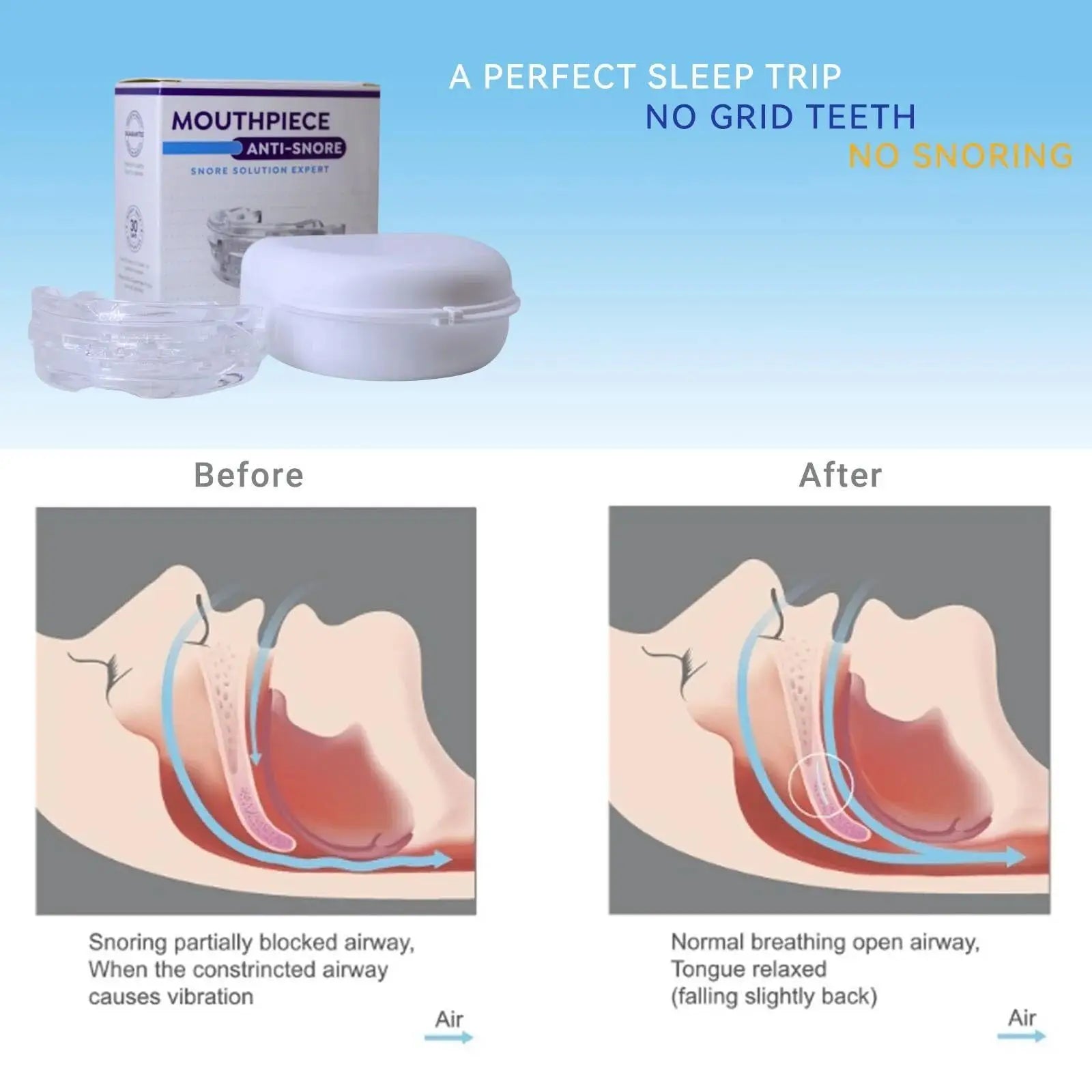 Transform Your Sleep with Our Adjustable Anti-Snoring Mouth Guard – Perfect for Bruxism Relief and Quality Rest!